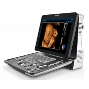 Mindray Z60 УЗИ аппарат цветной портативный