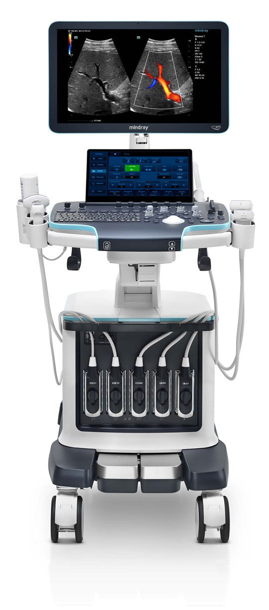 Mindray выходит на рынок премиального ультразвукового оборудования для радиологии